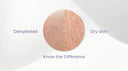 Dehydrated vs. Dry Skin: Know the Difference