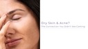Can Dry Skin Cause Acne? Understanding the Connection