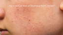 How to Get Rid of Redness from Acne: A Comprehensive Guide
