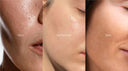 Oily, Dry, or Sensitive Skin? How to Pick the Perfect Moisturizer!