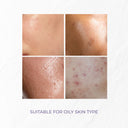 Hydrobloom Face Moisturizer | 100 ml
