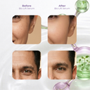 Before and after results of Bio Lift Serum showing improved skin texture and firmness